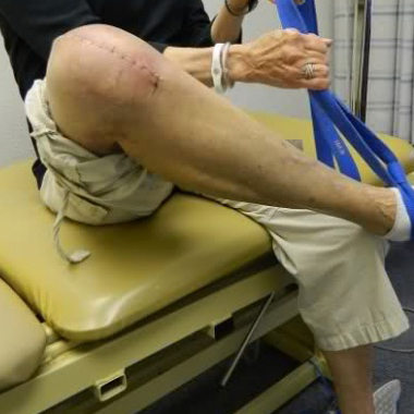 Recovery Pasca Ganti Sendi Lutut